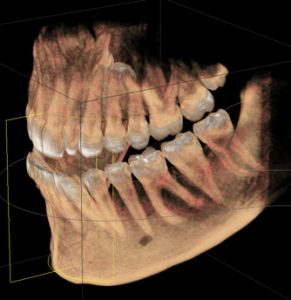 3D imaging