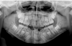 Orthopantomogram